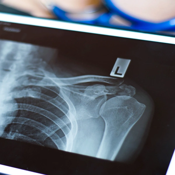 img-service-RADIOLOGÍA